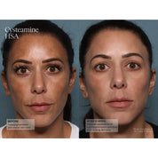 Cysteamine HSA
Pigment & Tone Corrector