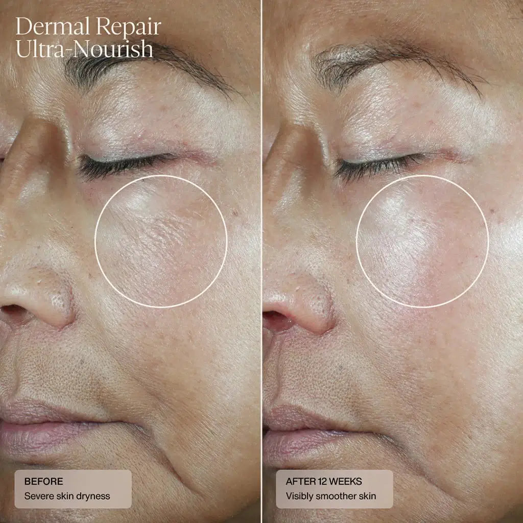 sente-dermal-repair-ultra-nourish-results-12wks.webp
