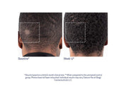 Obagi Nu-Cil BioStim™ Scalp Serum