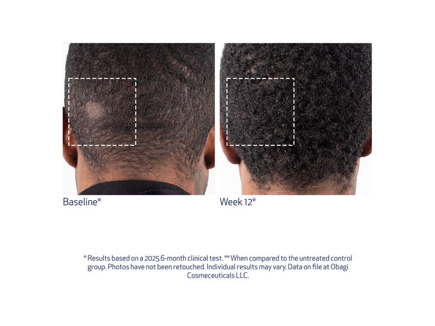 Obagi Nu-Cil BioStim™ Scalp Serum