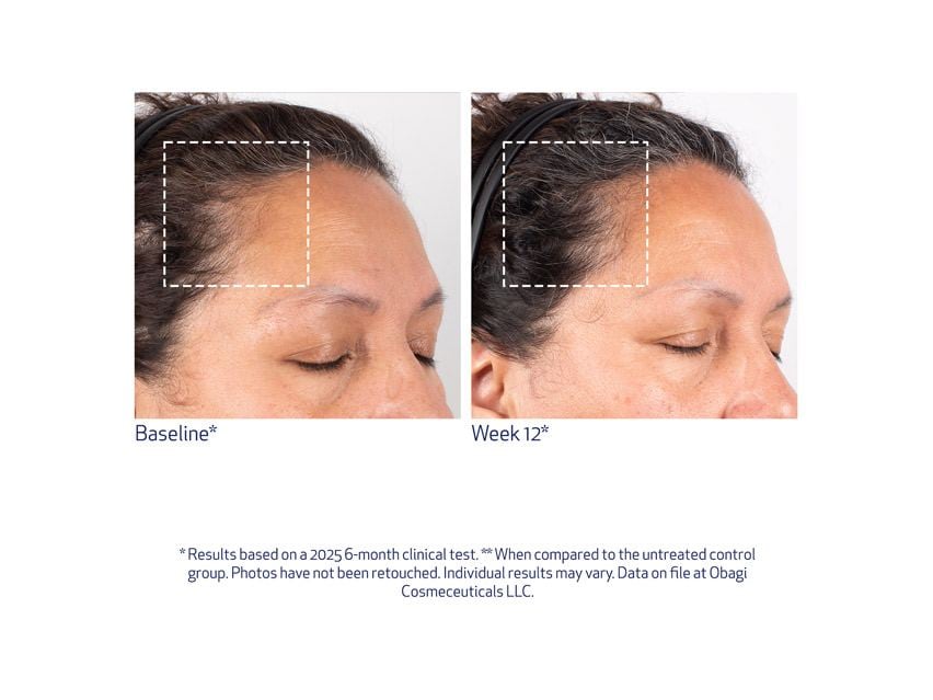 Obagi Nu-Cil BioStim™ Scalp Serum