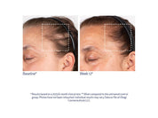 Obagi Nu-Cil BioStim™ Scalp Serum