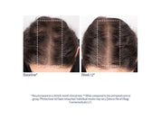 Obagi Nu-Cil BioStim™ Scalp Serum