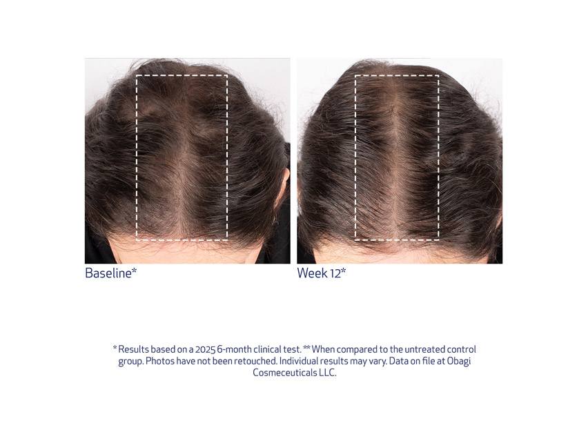 Obagi Nu-Cil BioStim™ Scalp Serum