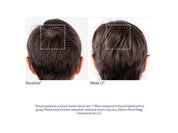 Obagi Nu-Cil BioStim™ Scalp Serum