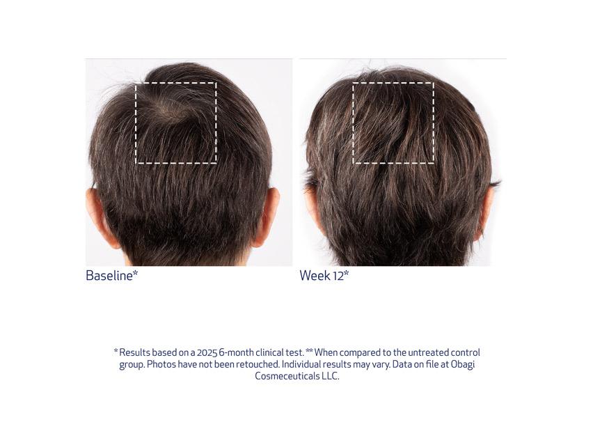 Obagi Nu-Cil BioStim™ Scalp Serum