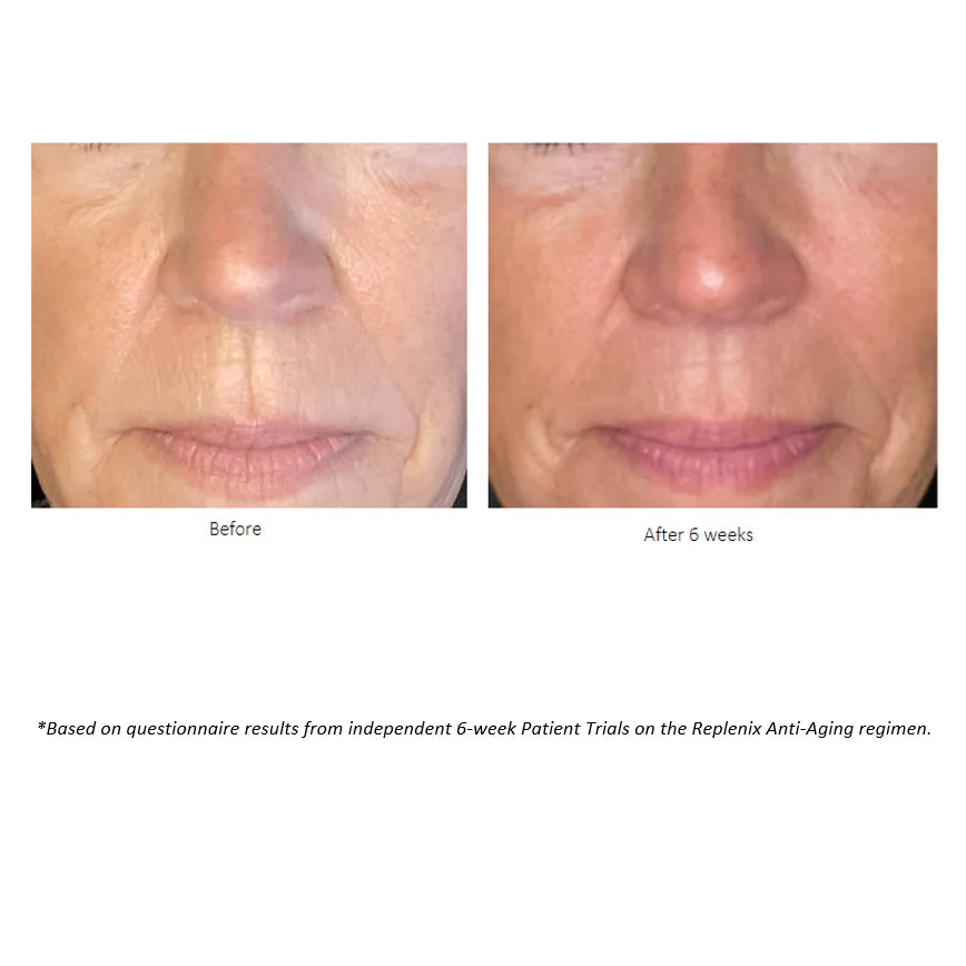 age-restore-brightening-moisturizer-results-6wk.webp