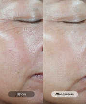 Revision Skincare C+ Correcting Complex 30%®