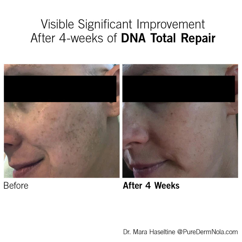 DNA Total Repair