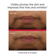 EltaMD UV Daily Hydration+