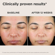 UV Skin Recovery Red Color Correcting Green Tint Broad Spectrum SPF 50