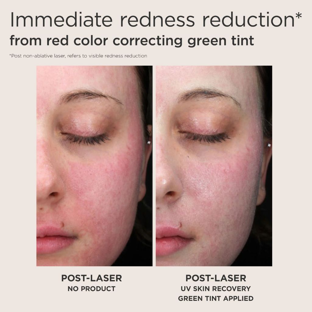 UV Skin Recovery Red Color Correcting Green Tint Broad Spectrum SPF 50