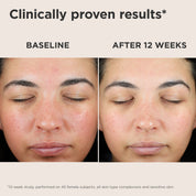 UV Skin Recovery Broad Spectrum SPF 50 Face Sunscreen