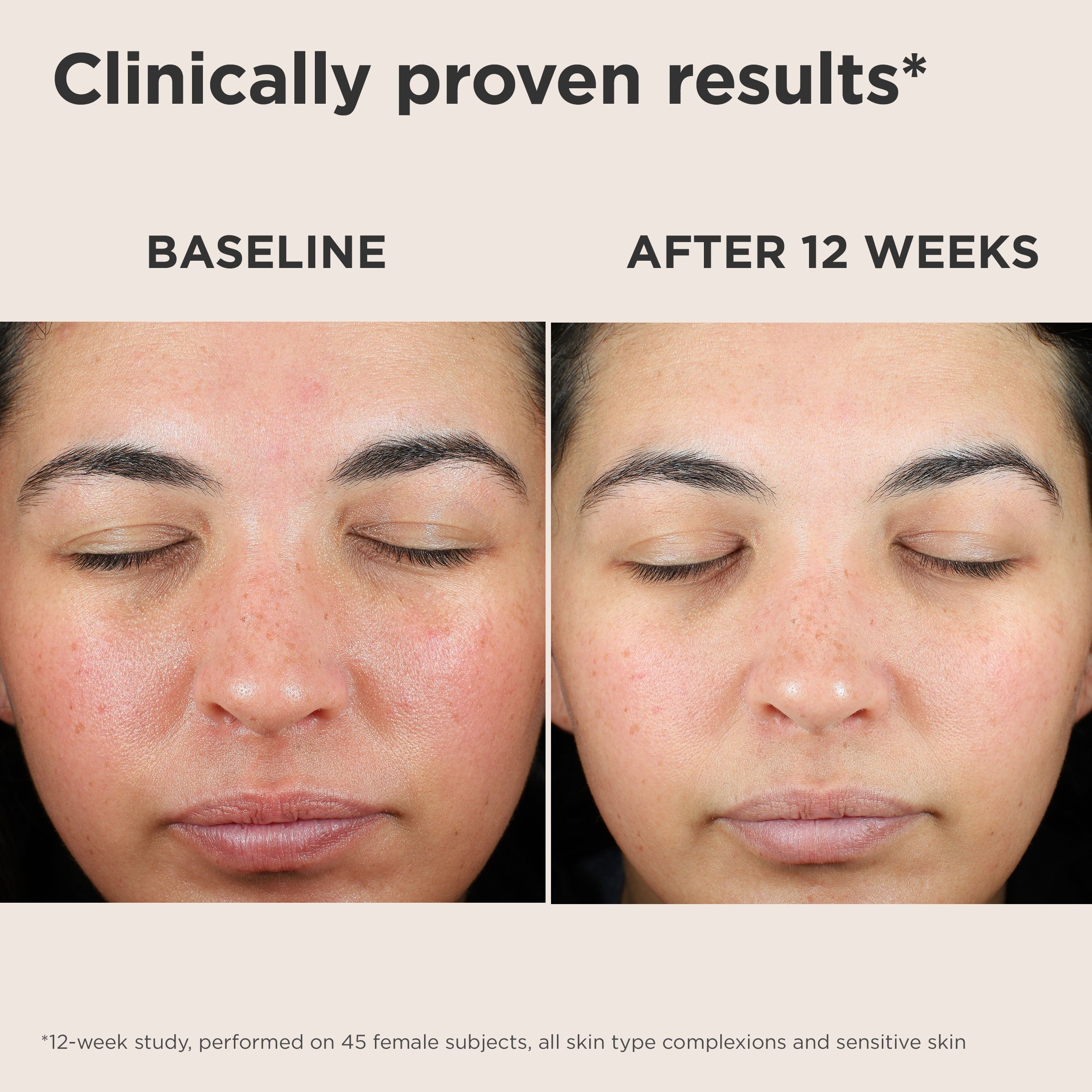 UV Skin Recovery Broad Spectrum SPF 50 Face Sunscreen