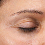 Emepelle Eye Cream results after 4 weeks