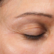 Emepelle Eye Cream baseline results