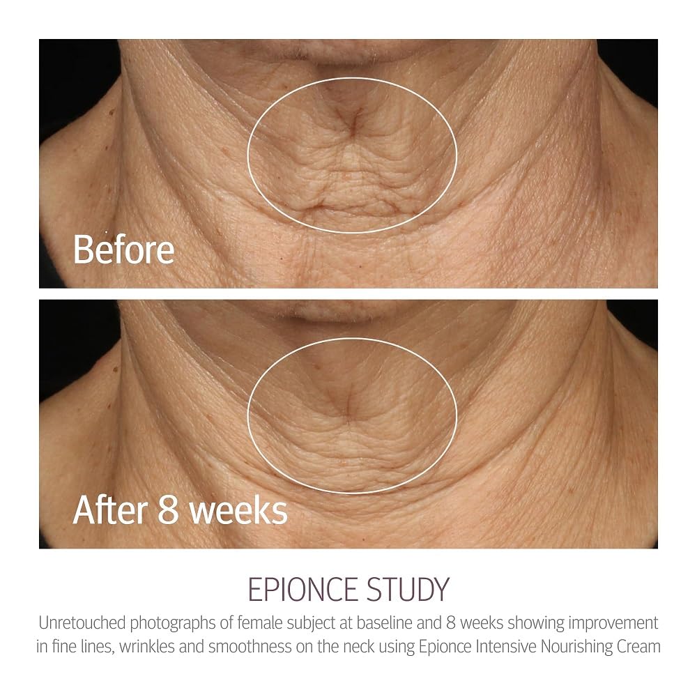 epionce-intensive-nourishing-cream-results-8wks.jpg