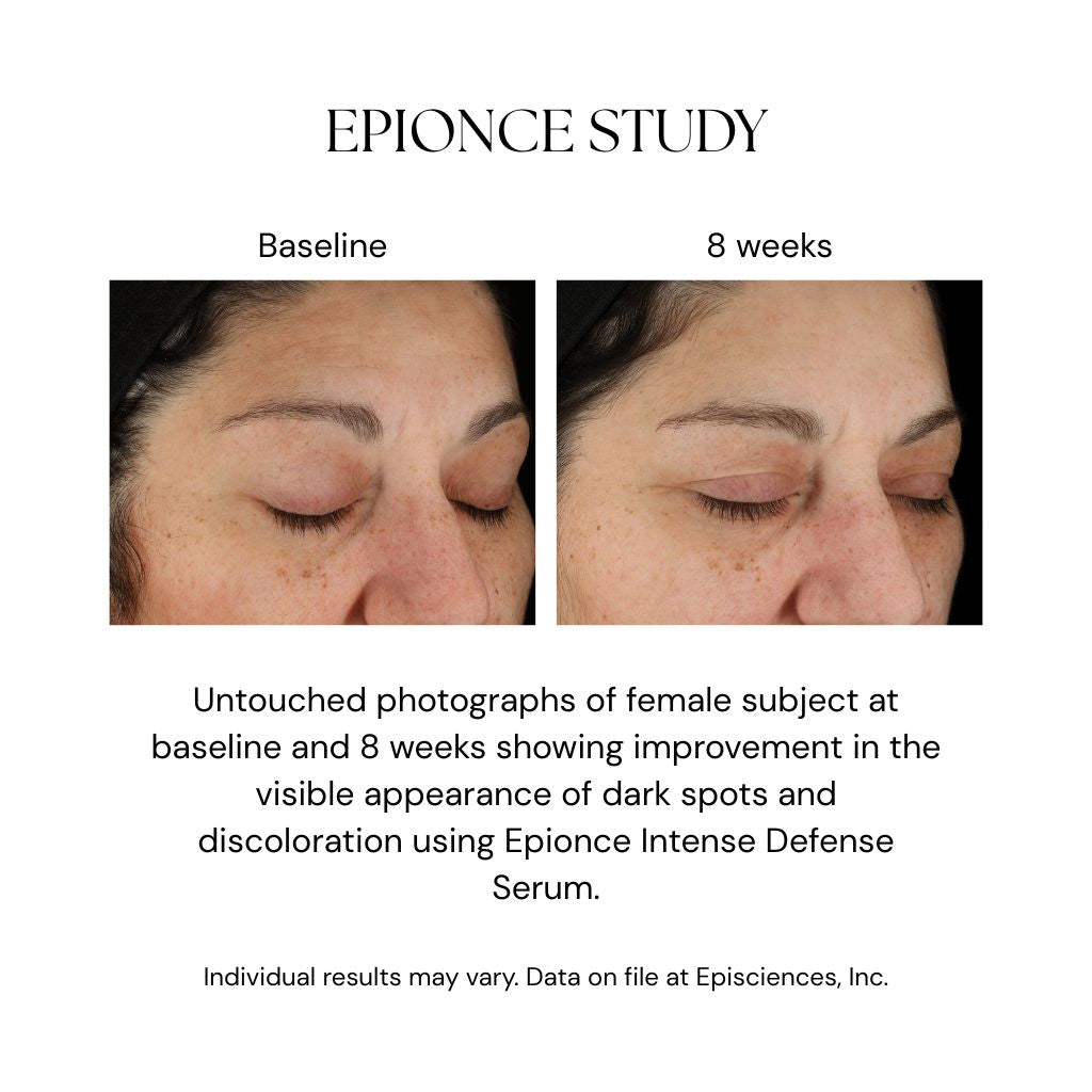 Intense Defense Serum