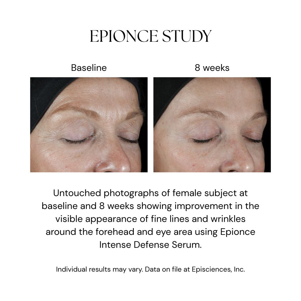 epionce-intese-defense-serum-results-8wks.jpg