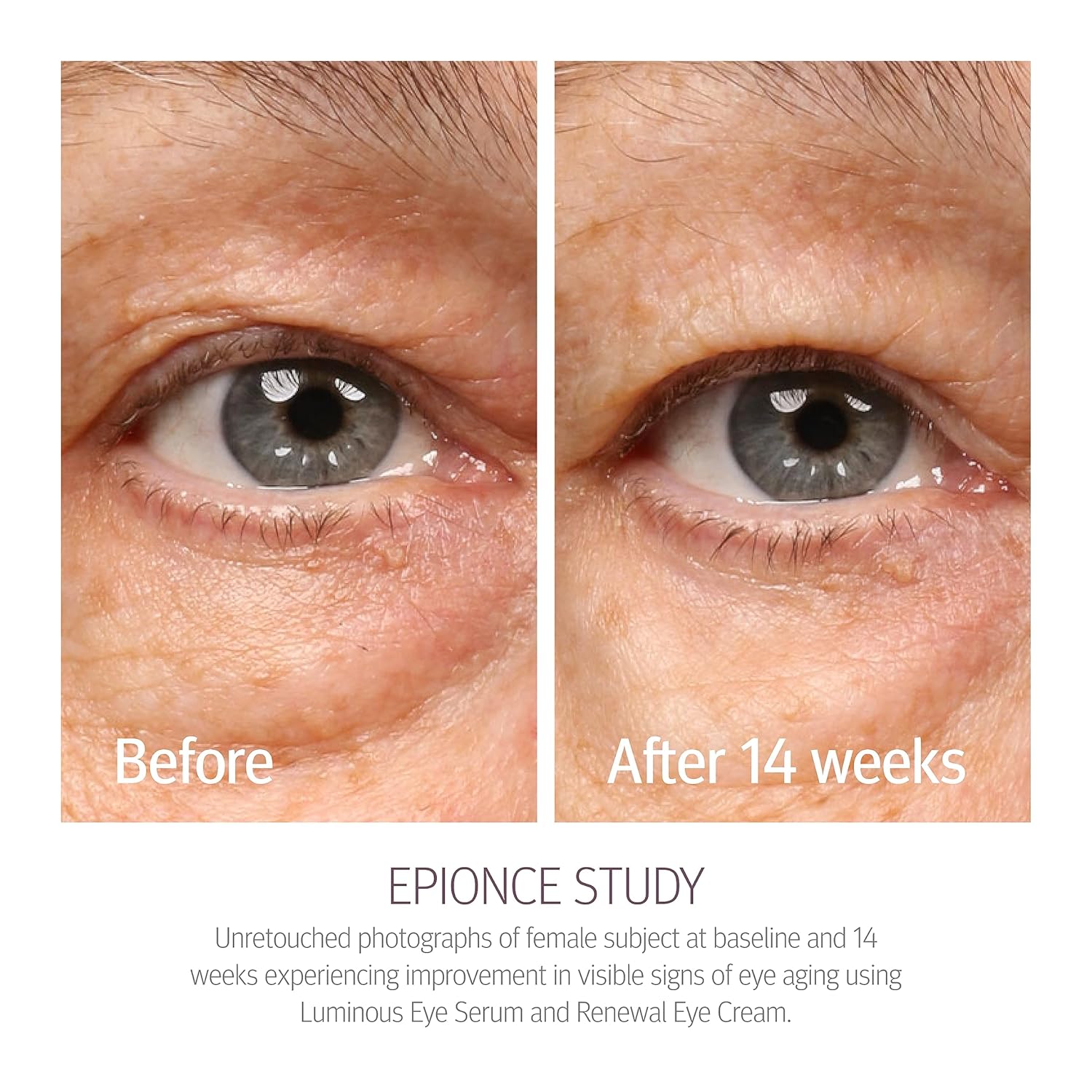 epionce-renewal-eye-cream-results-14wks.jpg