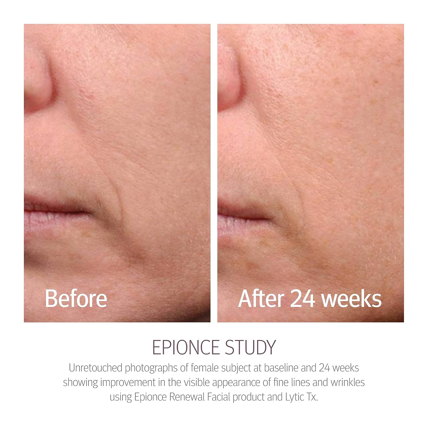 epionce-renewal-facial-lotion-results-24mo.jpg