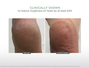 AHA + Ultra Softening Foot Cream