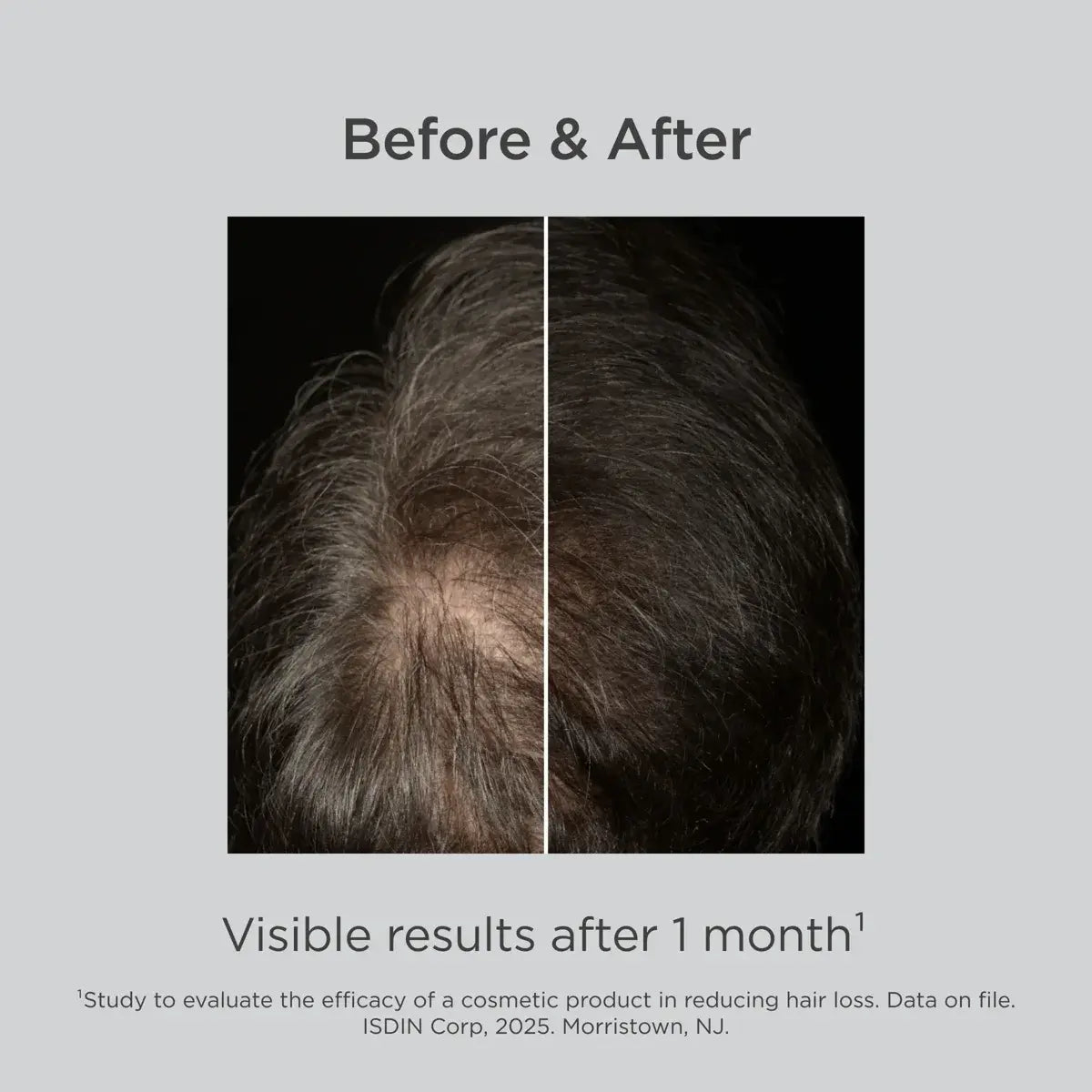 Lambdapil® Hair Density Lotion with Melatonin