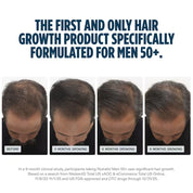nutrafol men 50+ supplement before and after comparison of improved hair growth in 3-9 months