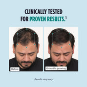 Men's Hair Growth Supplements