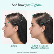 Postpartum Hair Growth Supplements