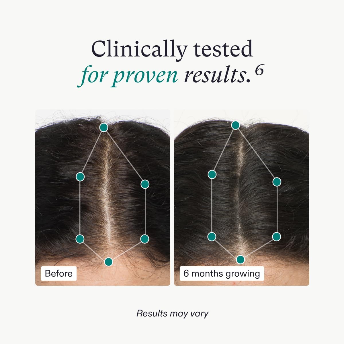 nutrafol-women-results-6mo.jpg