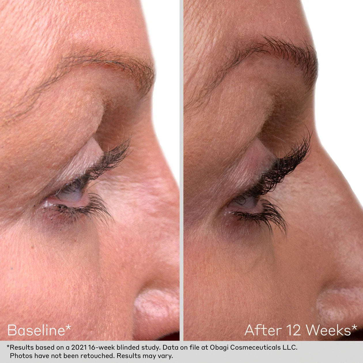 obagi-lash-and-brow-serum-set-results-12wks.webp