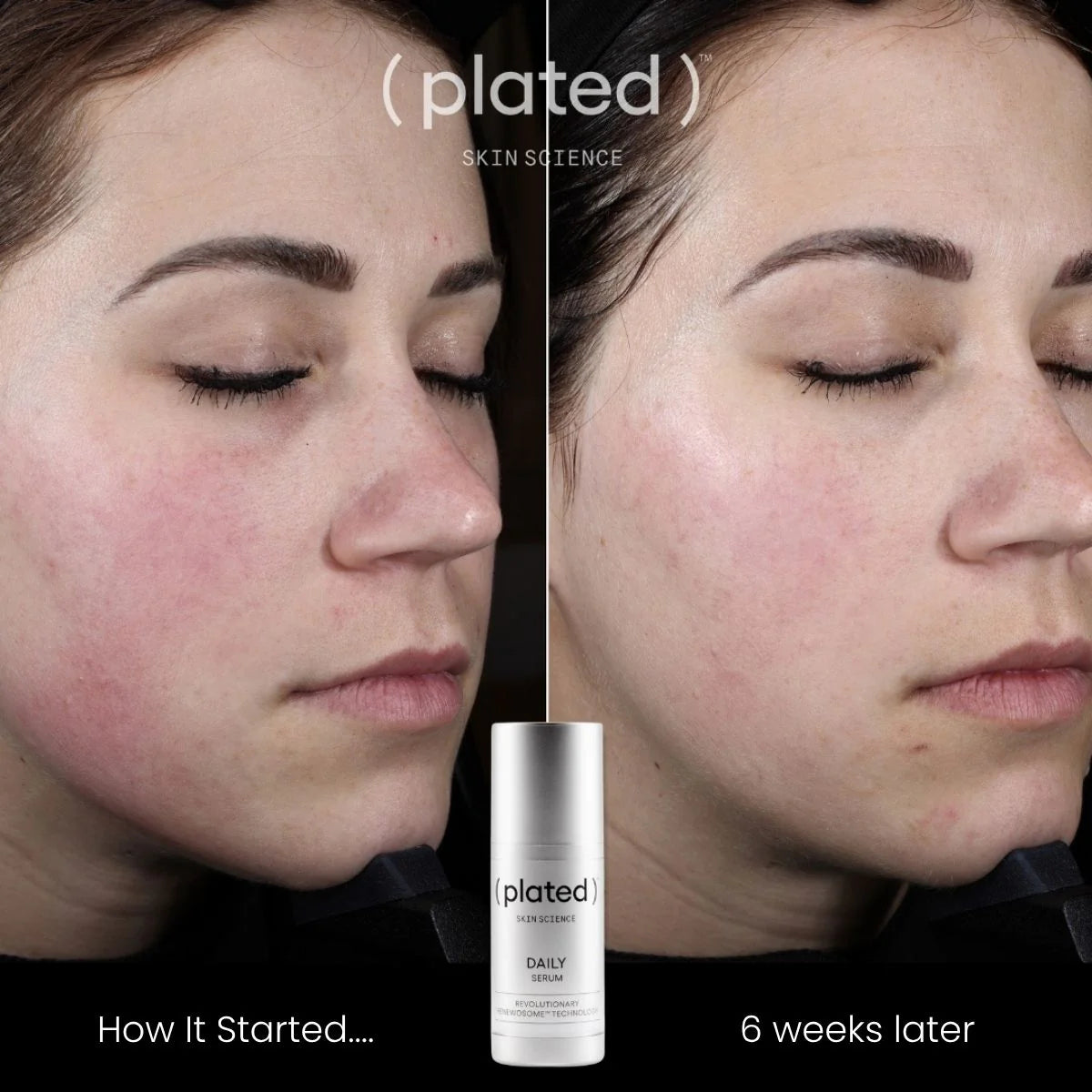plated-daily-serum-results-6wks.webp