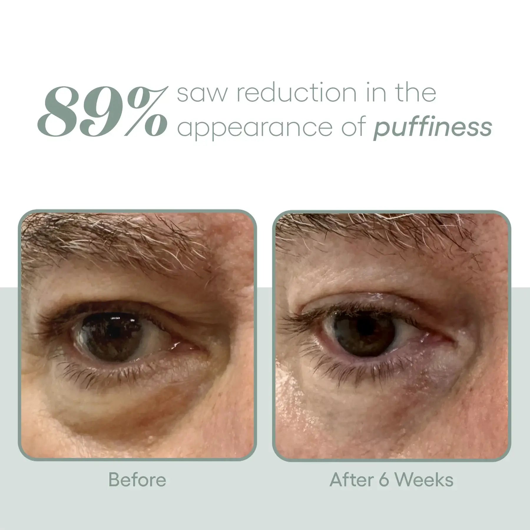 plated-eye-serum-results-1.webp