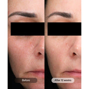 Revision Skincare D·E·J Daily Boosting Serum®