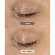 Revision Skincare D·E·J Eye Cream®