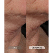 Revision Skincare Nectifirm® Advanced