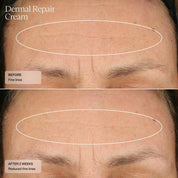 Dermal Repair Cream