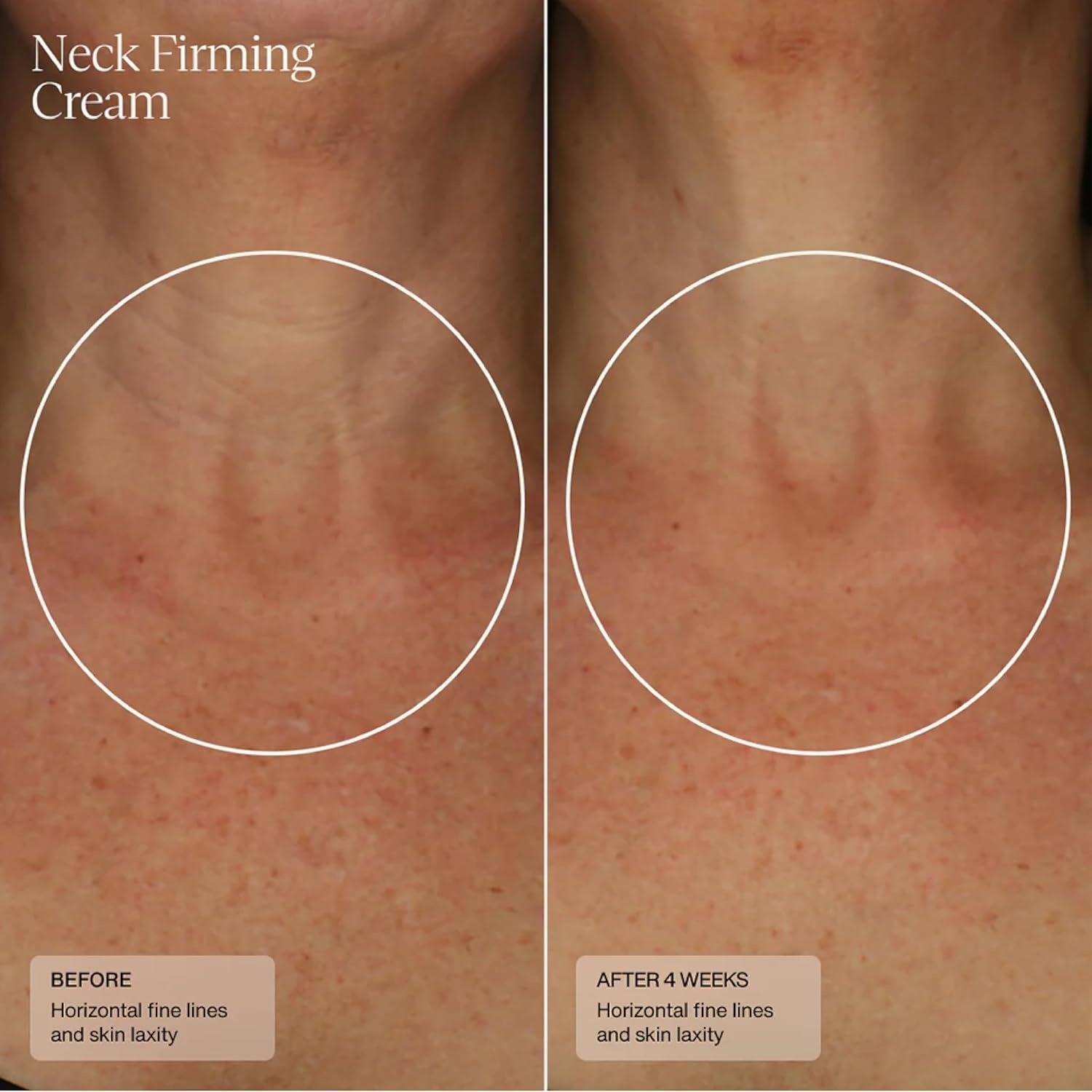 Neck Firming Cream