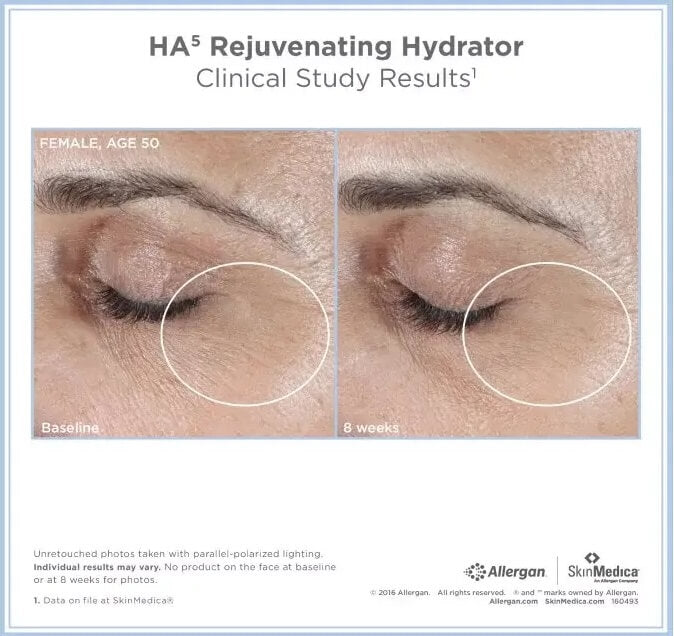 HA⁵® Rejuvenating Hydrator 2 oz