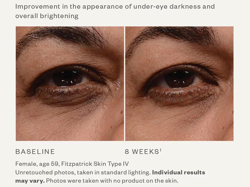 Instant Bright Eye Cream