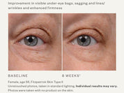 Instant Bright Eye Cream