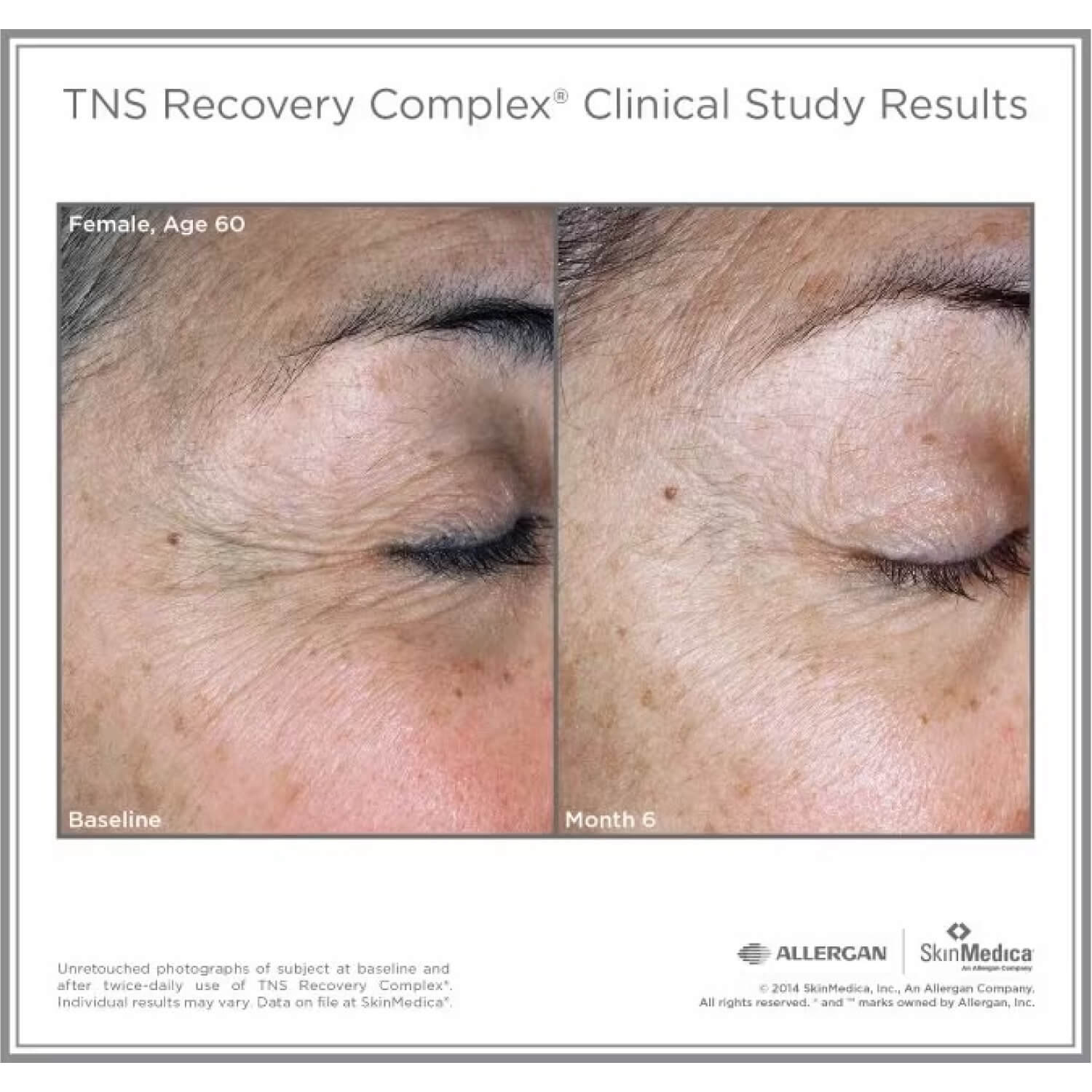 skinmedica-tns-recovery-complex-results.jpg